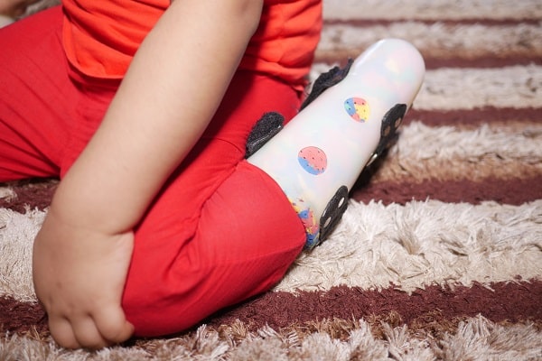 Child with cerebral palsy motor disability with leg orthosis