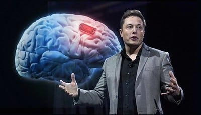 An image of Elon Musk during a presentation of the Neuralink chip