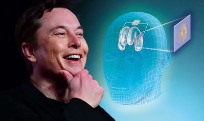 An image of Elon Musk with a Neuralink graphic. The Neuralink chip will be able to do amazing things, but can Neuralink cure paralysis?