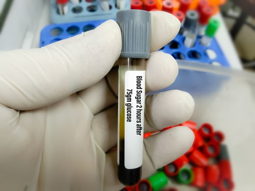 diabetes can be tested through a blood sugar test, like this test tube with blood demonstrates