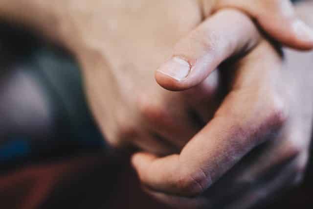 A close up of a person's hand holding another person's hand, potentially addressing arthritis or providing support.