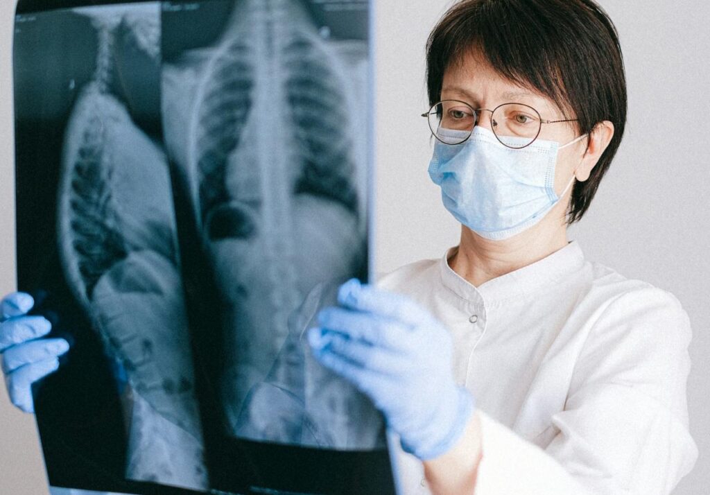 A doctor looks at the chest X-ray of a patient with poor lung capacity leading to knock-on effects such as finger clubbing